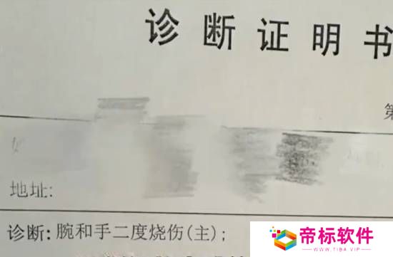 女子睡觉时充电中的手机突然爆炸 导致二度烧伤